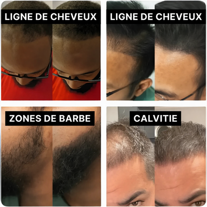 Hairline Powder