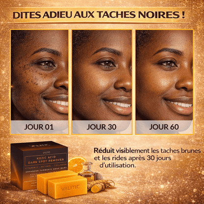 Savon Éclaircissant & Anti-Taches Noires